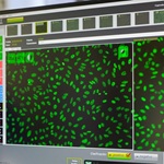 Imagen HGGB aportó al mundo nuevas imágenes de patrones inmunológicos