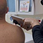 Imagen Moderno dermatoscopio arribó al Policlínico de Dermatología